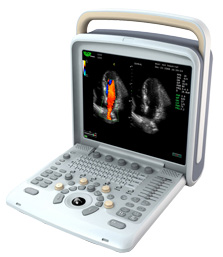 CHISON Q6